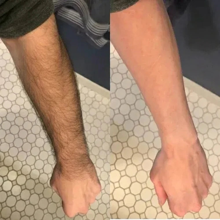 Sensitive Hair Removal Spray