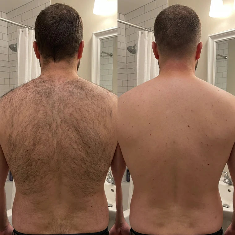 Sensitive Hair Removal Spray